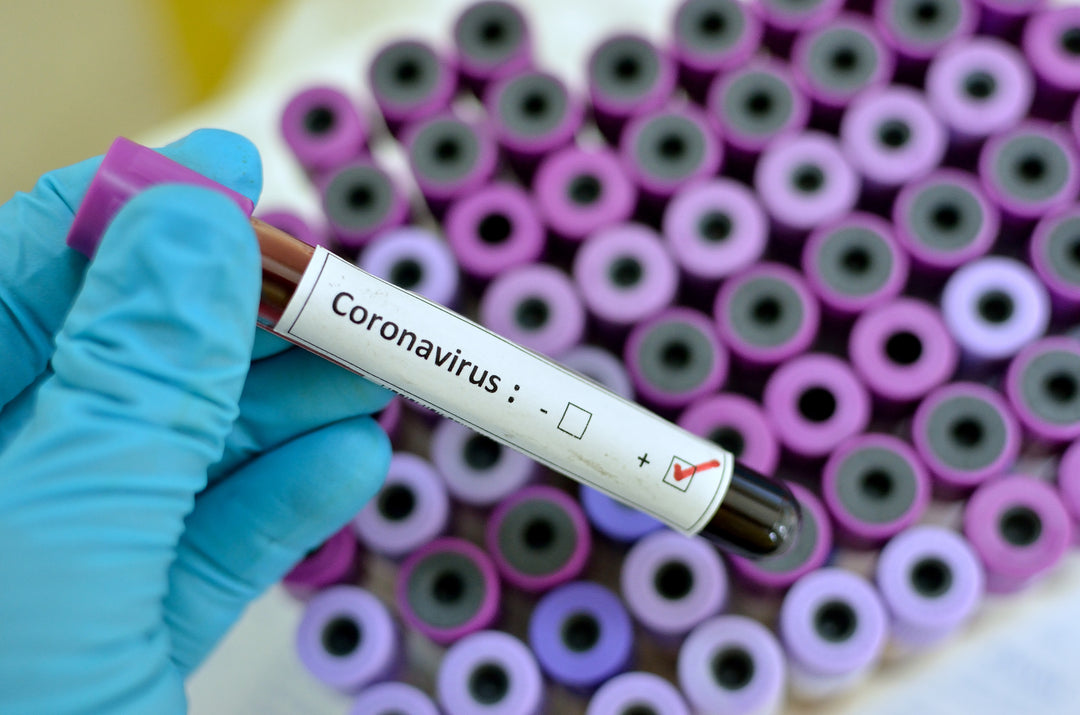 Tips for Avoiding the Coronavirus
