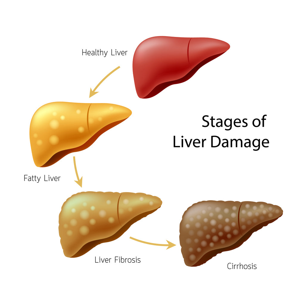 Liver Health: Signs of Liver Failure